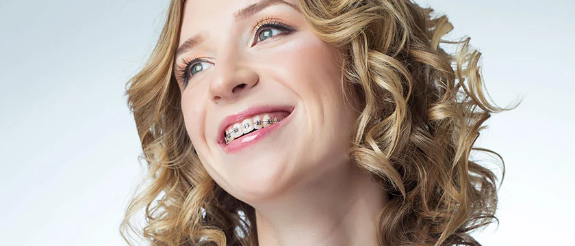 How Do Braces Work At Correcting Crooked Teeth?