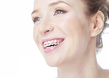 orthodontic braces in randwick